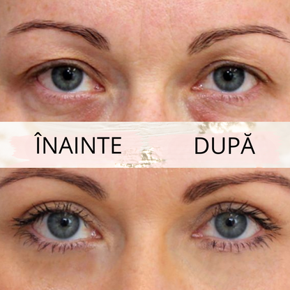 Eyelid PushUp 🤩 Privire Instantanee ✨ 120 Perechi! 😱