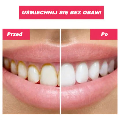 TOOTHCLEANSO – Curățare Orală Avansată cu Jet de Apă
